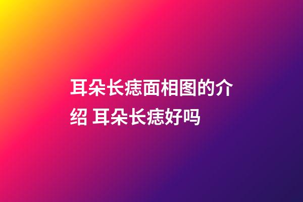 耳朵长痣面相图的介绍 耳朵长痣好吗